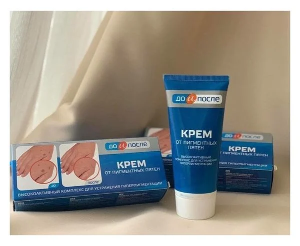 Kem Trị Đồi Mồi Tay Kpem Nga 50ml